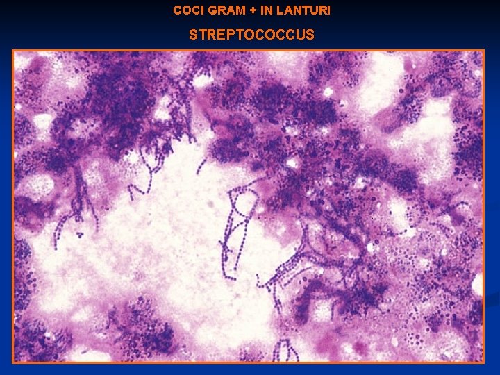 COCI GRAM + IN LANTURI STREPTOCOCCUS 