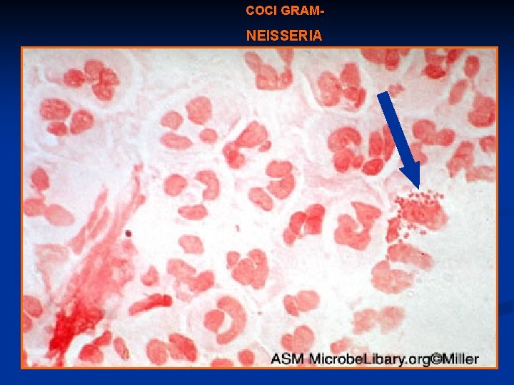 COCI GRAM- NEISSERIA 