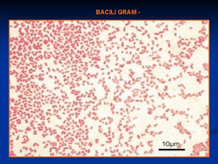 BACILI GRAM - 