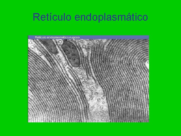 Retículo endoplasmático 