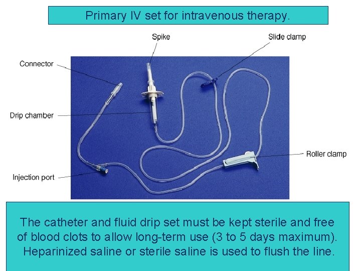 Primary IV set for intravenous therapy. The catheter and fluid drip set must be