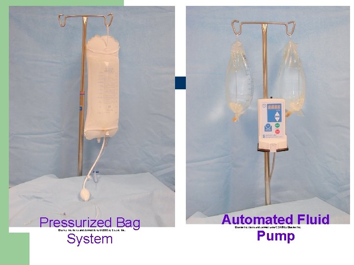 Pressurized Bag System Automated Fluid Pump 