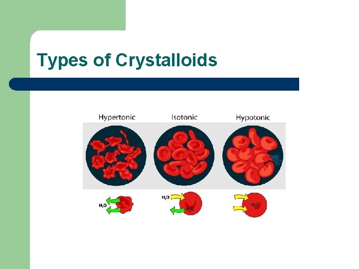 Types of Crystalloids 