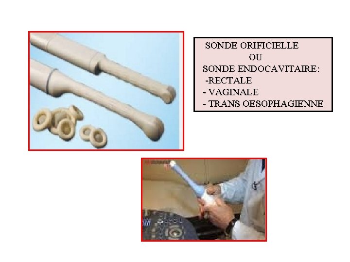 SONDE ORIFICIELLE OU SONDE ENDOCAVITAIRE: -RECTALE - VAGINALE - TRANS OESOPHAGIENNE 