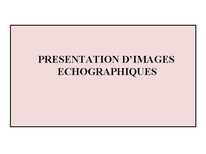 PRESENTATION D’IMAGES ECHOGRAPHIQUES 