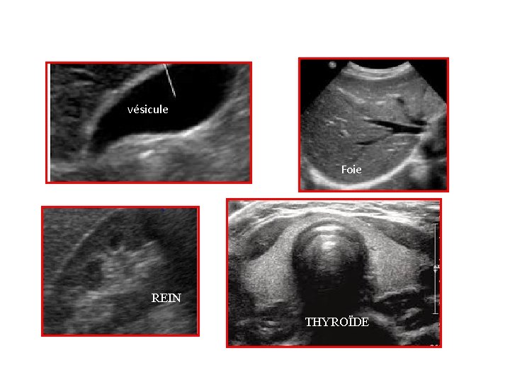 vésicule Foie REIN THYROÏDE 