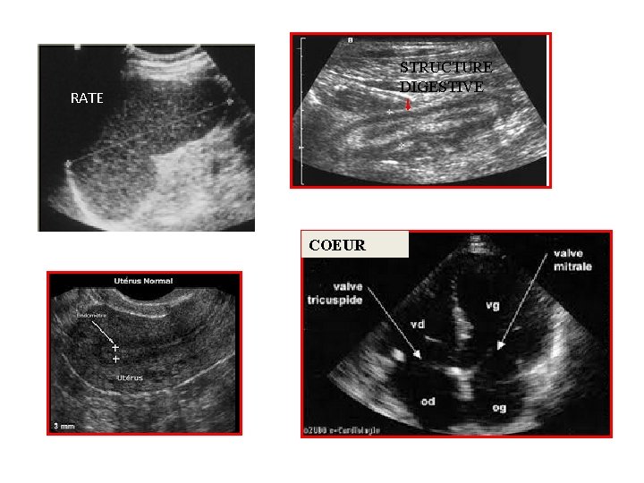 STRUCTURE DIGESTIVE RATE COEUR 