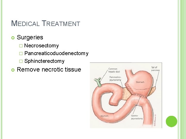 MEDICAL TREATMENT Surgeries � Necrosectomy � Pancreaticoduodenectomy � Sphincterectomy Remove necrotic tissue MEDICAL TREATMENT Surgeries � Necrosectomy � Pancreaticoduodenectomy � Sphincterectomy Remove necrotic tissue