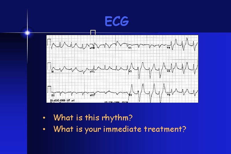 ECG � • What is this rhythm? • What is your immediate treatment? 