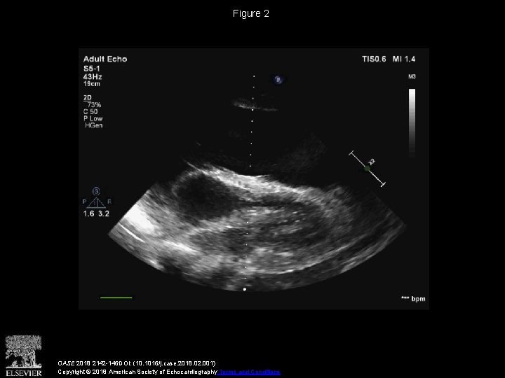 Figure 2 CASE 2018 2142 -146 DOI: (10. 1016/j. case. 2018. 02. 001) Copyright