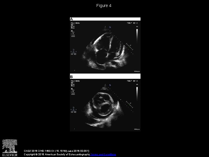 Figure 4 CASE 2018 2142 -146 DOI: (10. 1016/j. case. 2018. 02. 001) Copyright