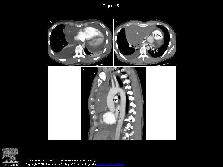 Figure 5 CASE 2018 2142 -146 DOI: (10. 1016/j. case. 2018. 02. 001) Copyright