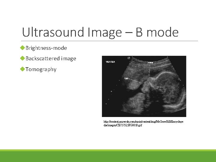 Ultrasound Image – B mode u. Brightness-mode u. Backscattered image u. Tomography http: //content.