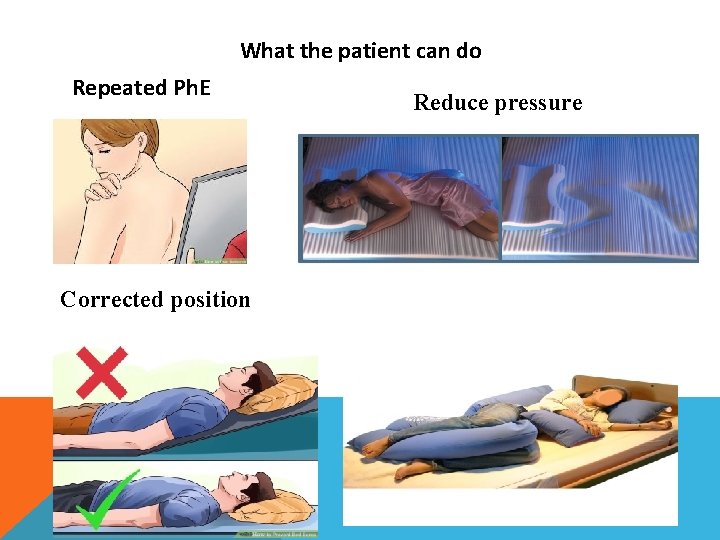 What the patient can do Repeated Ph. E Corrected position Reduce pressure 