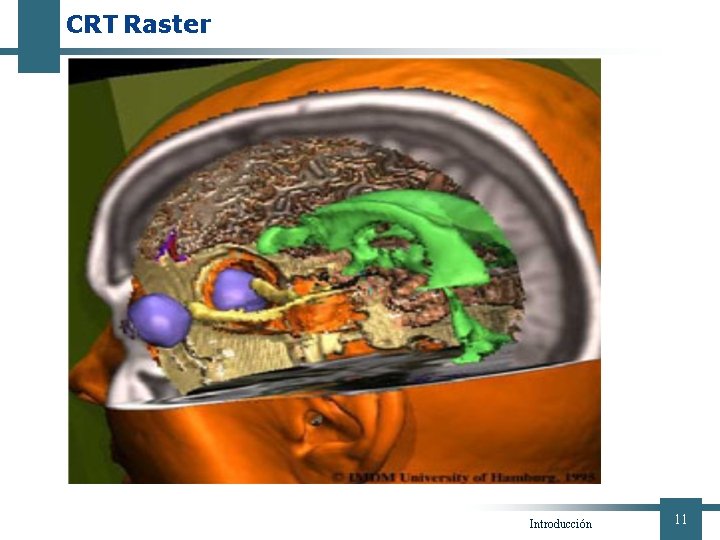 CRT Raster Introducción 11 