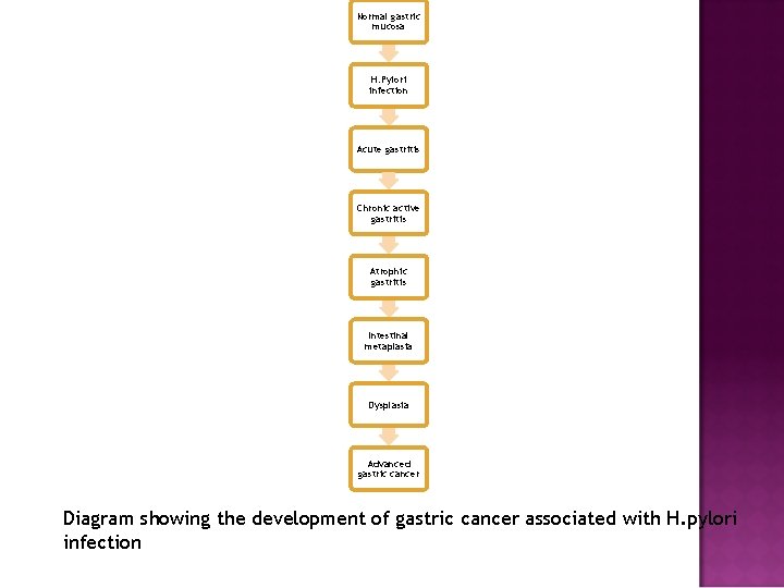 Normal gastric mucosa H. Pylori infection Acute gastritis Chronic active gastritis Atrophic gastritis Intestinal