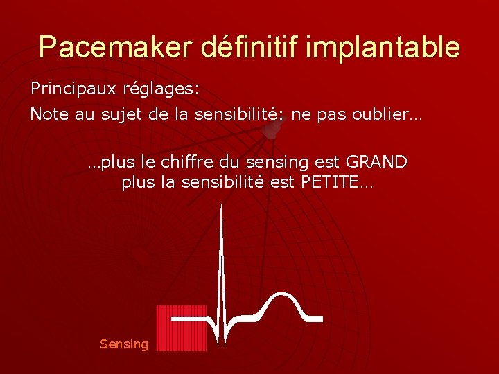 Pacemaker définitif implantable Principaux réglages: Note au sujet de la sensibilité: ne pas oublier…