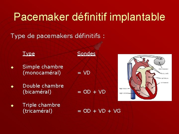 Pacemaker définitif implantable Type de pacemakers définitifs : u u u Type Sondes Simple