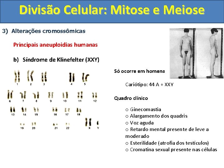 Divisão Celular: Mitose e Meiose 3) Alterações cromossômicas Principais aneuploidias humanas b) Síndrome de Divisão Celular: Mitose e Meiose 3) Alterações cromossômicas Principais aneuploidias humanas b) Síndrome de
