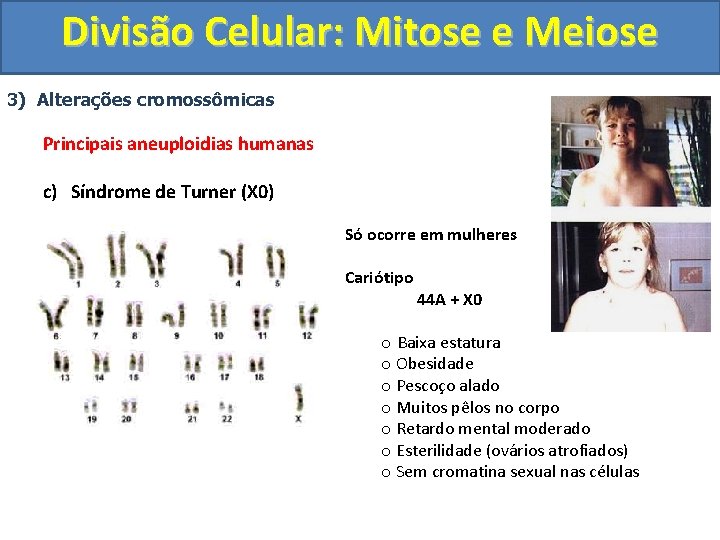 Divisão Celular: Mitose e Meiose 3) Alterações cromossômicas Principais aneuploidias humanas c) Síndrome de Divisão Celular: Mitose e Meiose 3) Alterações cromossômicas Principais aneuploidias humanas c) Síndrome de