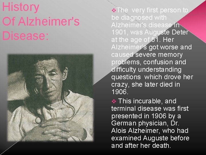 History Of Alzheimer's Disease: The very first person to be diagnosed with Alzheimer's disease