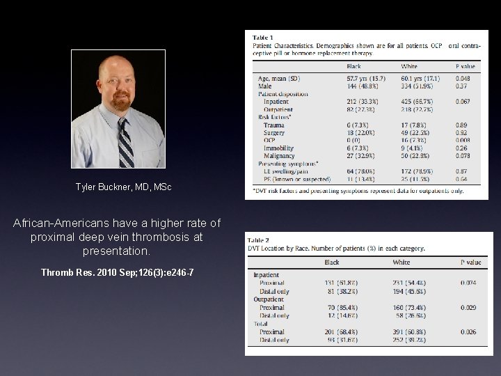 Tyler Buckner, MD, MSc African-Americans have a higher rate of proximal deep vein thrombosis