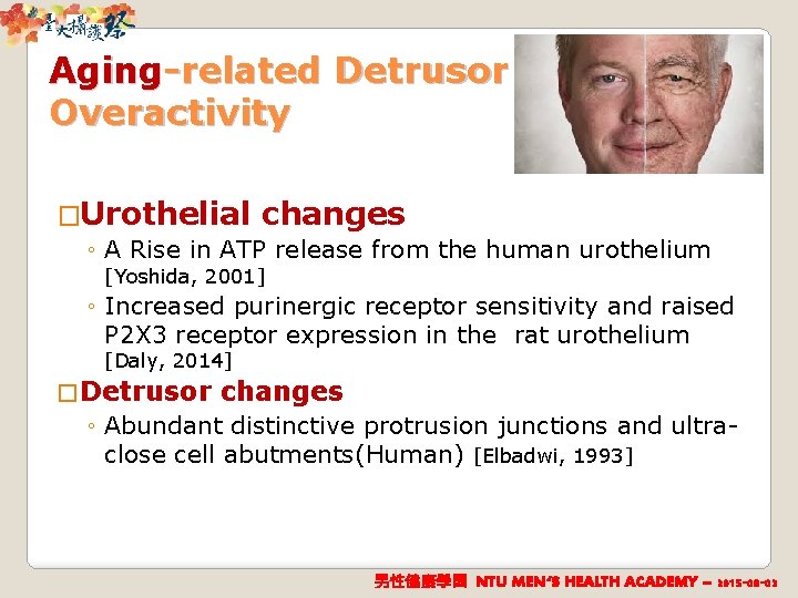 Aging-related Detrusor Overactivity �Urothelial changes ◦ A Rise in ATP release from the human