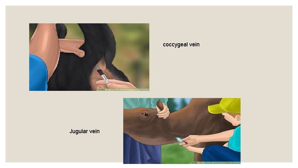 coccygeal vein Jugular vein 