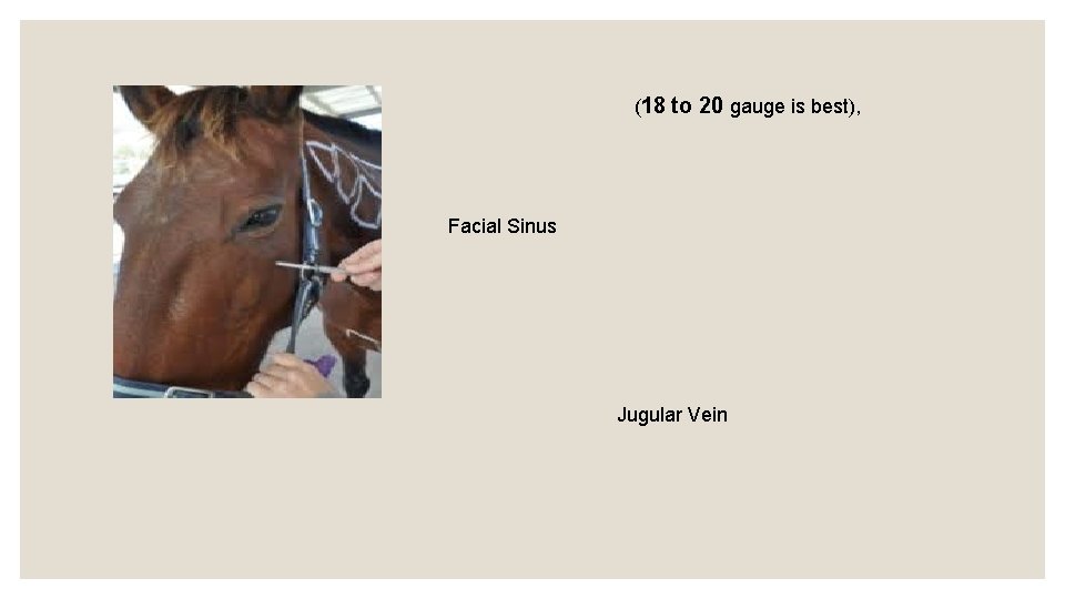 (18 to 20 gauge is best), Facial Sinus Jugular Vein 