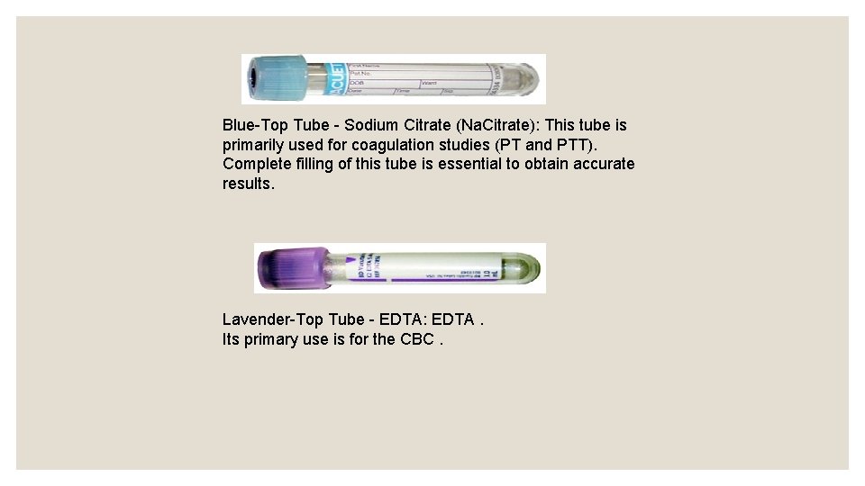 Blue-Top Tube - Sodium Citrate (Na. Citrate): This tube is primarily used for coagulation