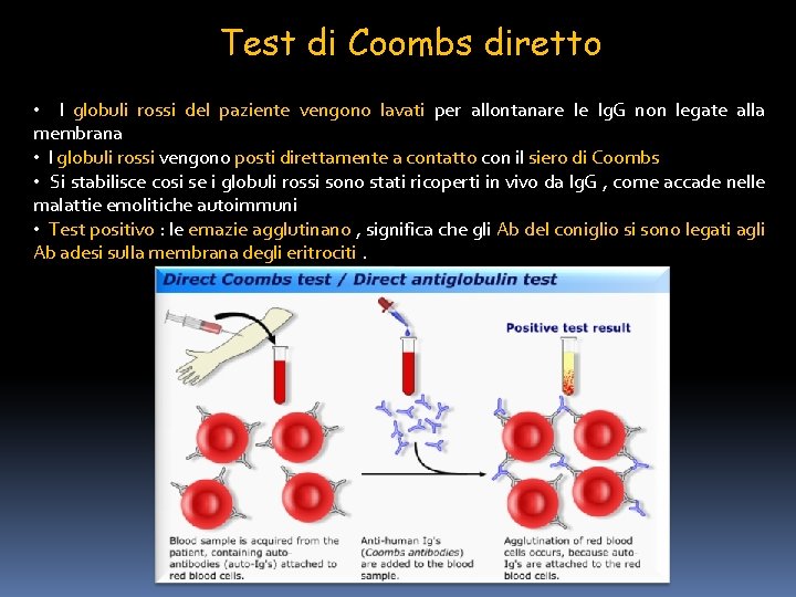 Test di Coombs diretto • I globuli rossi del paziente vengono lavati per allontanare