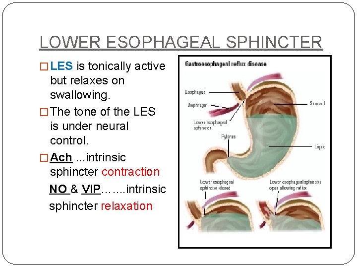 LOWER ESOPHAGEAL SPHINCTER � LES is tonically active but relaxes on swallowing. � The