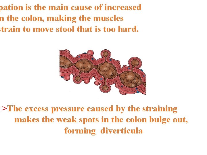 pation is the main cause of increased n the colon, making the muscles strain