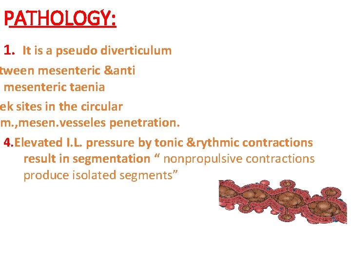 PATHOLOGY: 1. It is a pseudo diverticulum tween mesenteric &anti mesenteric taenia ek sites