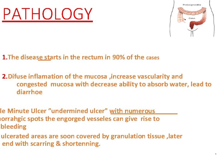 PATHOLOGY 1. The disease starts in the rectum in 90% of the cases 2.