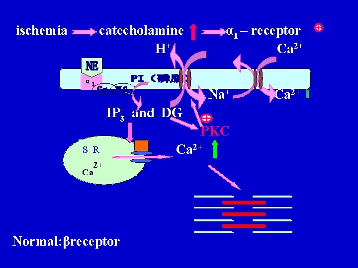 ischemia catecholamine H+ α 1 – receptor Ca 2+ α 1 Na+ IP 3 ischemia catecholamine H+ α 1 – receptor Ca 2+ α 1 Na+ IP 3