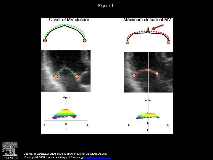 Figure 1 Journal of Cardiology 2009 5394 -101 DOI: (10. 1016/j. jjcc. 2008. 09.