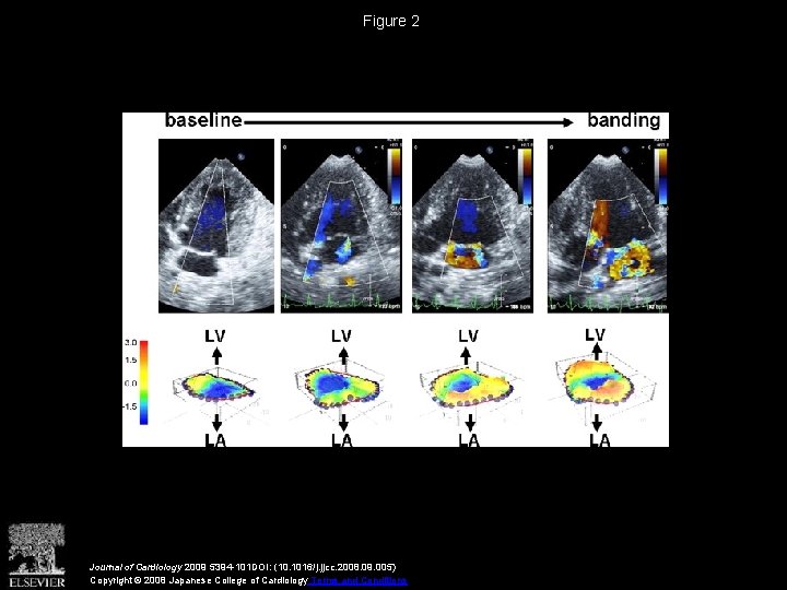 Figure 2 Journal of Cardiology 2009 5394 -101 DOI: (10. 1016/j. jjcc. 2008. 09.