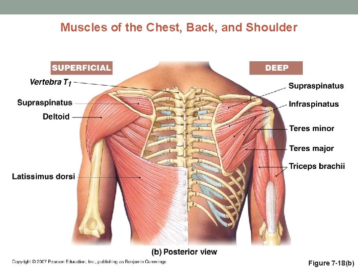 Muscles of the Chest, Back, and Shoulder Figure 7 -18(b) 