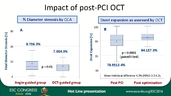 Impact of post-PCI OCT 30 20 Stent expansion as assessed by OCT 100 A