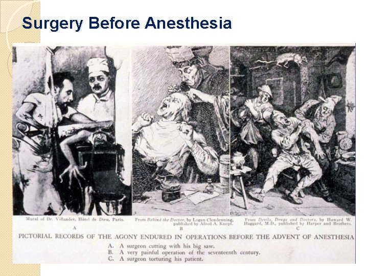 Surgery Before Anesthesia 