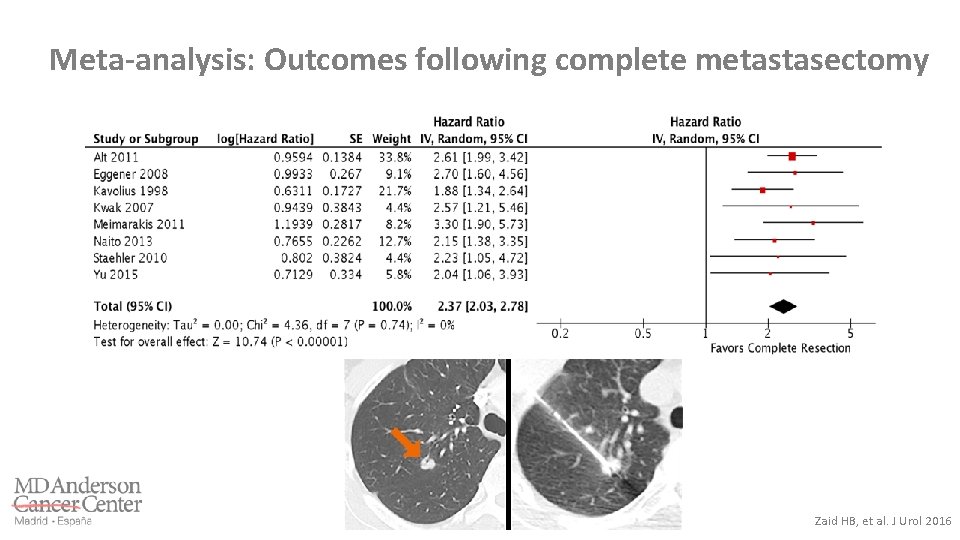 Meta-analysis: Outcomes following complete metastasectomy Zaid HB, et al. J Urol 2016 