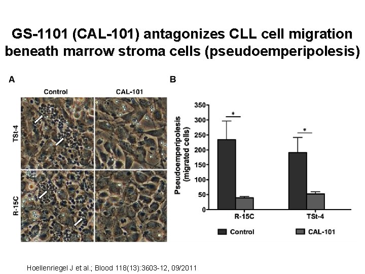 GS-1101 (CAL-101) antagonizes CLL cell migration beneath marrow stroma cells (pseudoemperipolesis) Hoellenriegel J et
