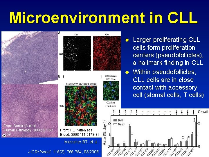 Microenvironment in CLL ® ® From: Soma LA et al, Human Pathology. 2006; 37: