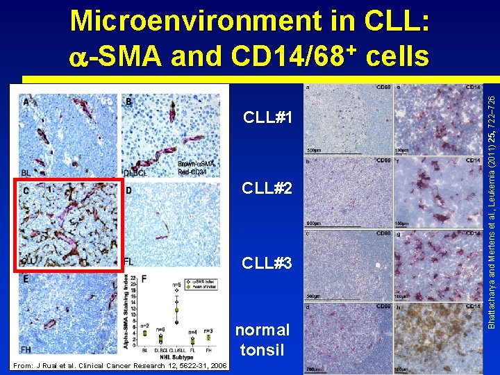 CLL#1 CLL#2 CLL#3 normal tonsil From: J Rual et al. Clinical Cancer Research 12,