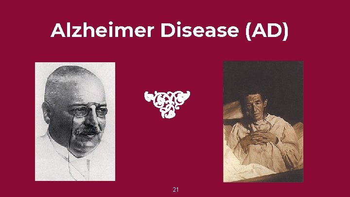 Alzheimer Disease (AD) 21 