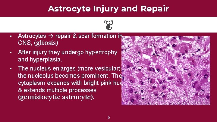 Astrocyte Injury and Repair ▪ Astrocytes repair & scar formation in CNS, (gliosis) ▪