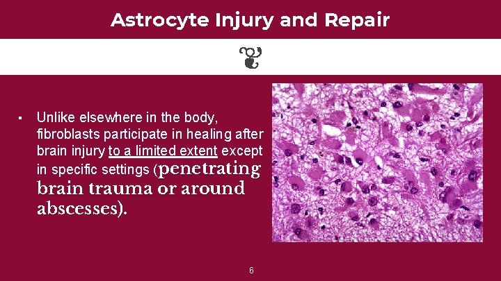 Astrocyte Injury and Repair ▪ Unlike elsewhere in the body, fibroblasts participate in healing