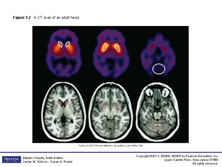 Figure 1. 2 A CT scan of an adult head. Electric Circuits, Ninth Edition