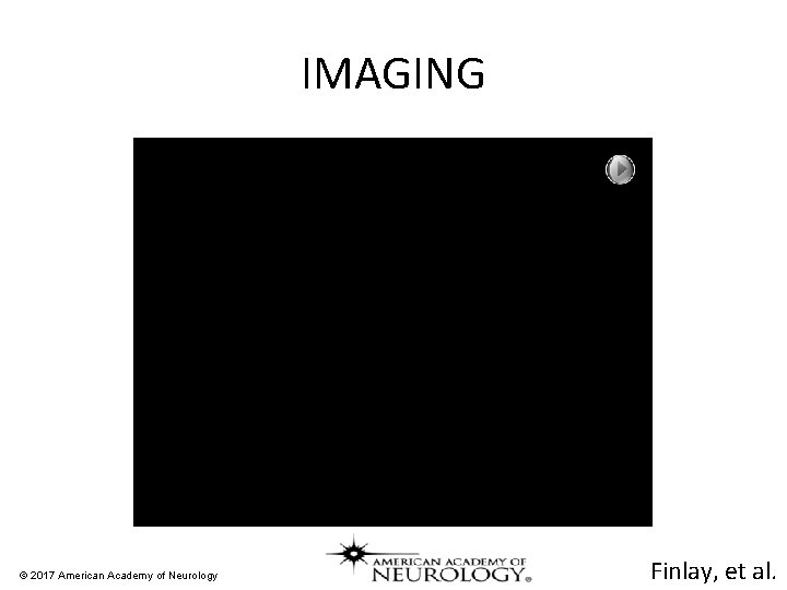 IMAGING © 2017 American Academy of Neurology Finlay, et al. 